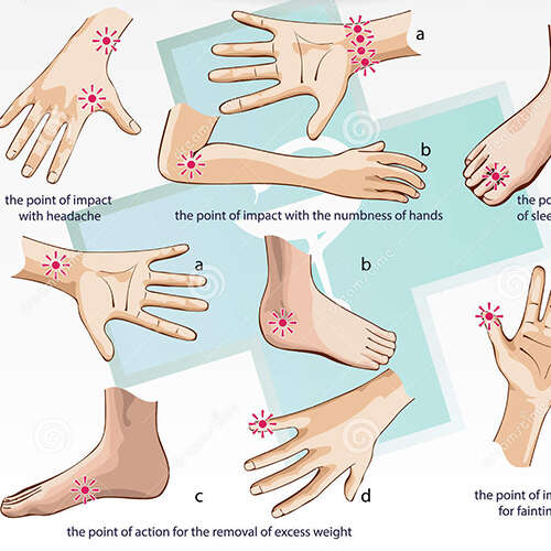 Acupressure